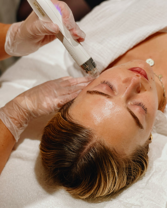 Let's Talk Micro-Needling